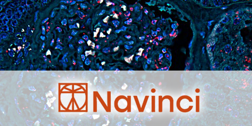 Navinci – NaveniFlex Tissue Proximity Ligation Kits